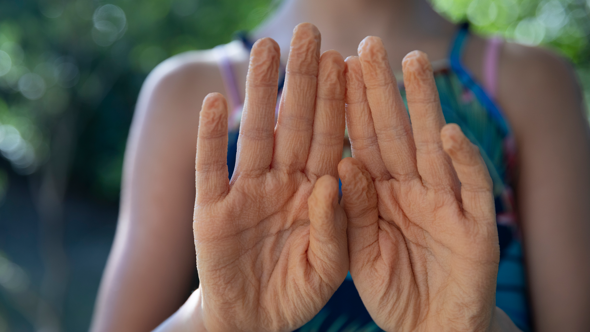 Your fingers wrinkle the the same system at any time when they’re in water